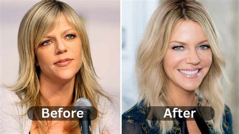 kaitlin olsen plastic surgery|Kaitlin Olsons Plastic Surgery